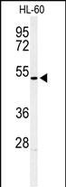 HOXA3 Antibody in Western Blot (WB)