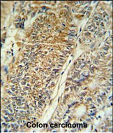 PYCR1 Antibody in Immunohistochemistry (Paraffin) (IHC (P))