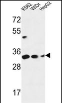 PYCR1 Antibody in Western Blot (WB)