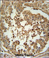 DIPK2A Antibody in Immunohistochemistry (Paraffin) (IHC (P))