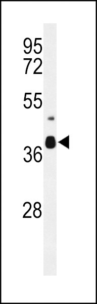 DIPK2A Antibody in Western Blot (WB)
