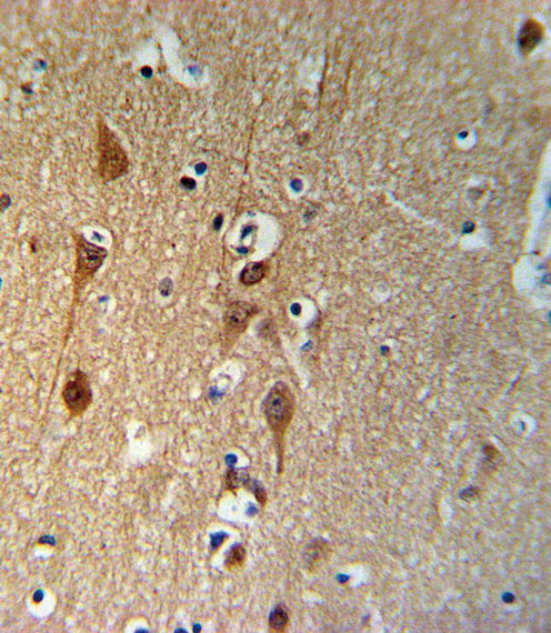 SMAD3 Antibody in Immunohistochemistry (Paraffin) (IHC (P))