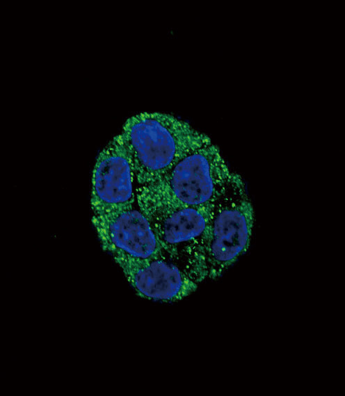 PLA2G6 Antibody in Immunocytochemistry (ICC/IF)