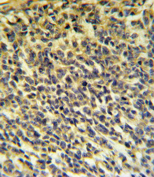 PLA2G6 Antibody in Immunohistochemistry (Paraffin) (IHC (P))