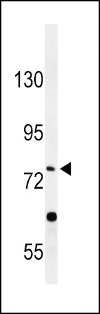 PLA2G6 Antibody in Western Blot (WB)