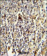 CD1e Antibody in Immunohistochemistry (Paraffin) (IHC (P))