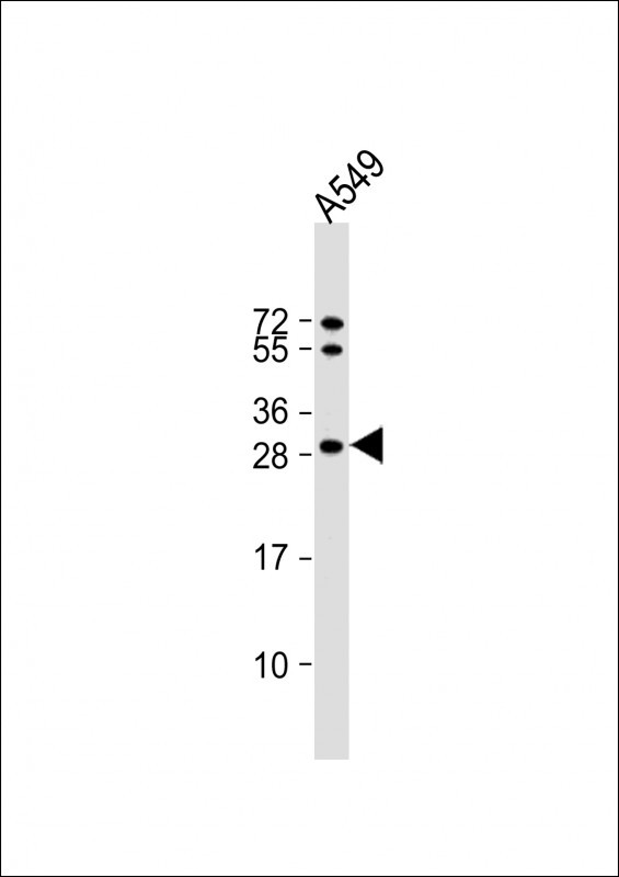 SPR Antibody in Western Blot (WB)