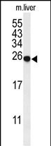 SPR Antibody in Western Blot (WB)