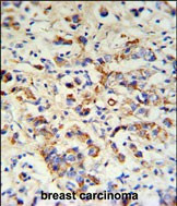 DCT Antibody in Immunohistochemistry (Paraffin) (IHC (P))