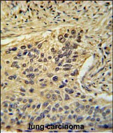 TAF2 Antibody in Immunohistochemistry (Paraffin) (IHC (P))