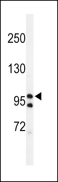 TAF2 Antibody in Western Blot (WB)