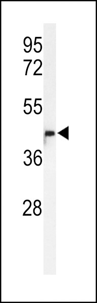 METTL17 Antibody in Western Blot (WB)