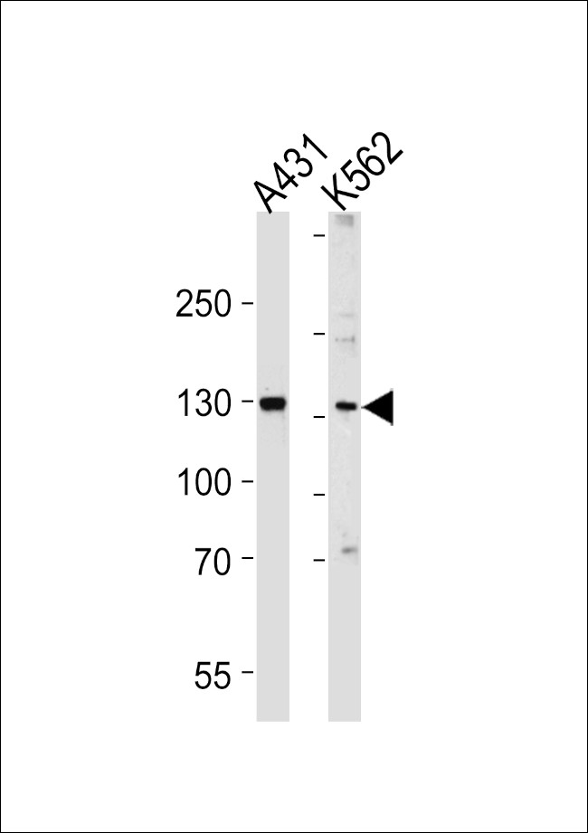 GALNT5 Antibody in Western Blot (WB)