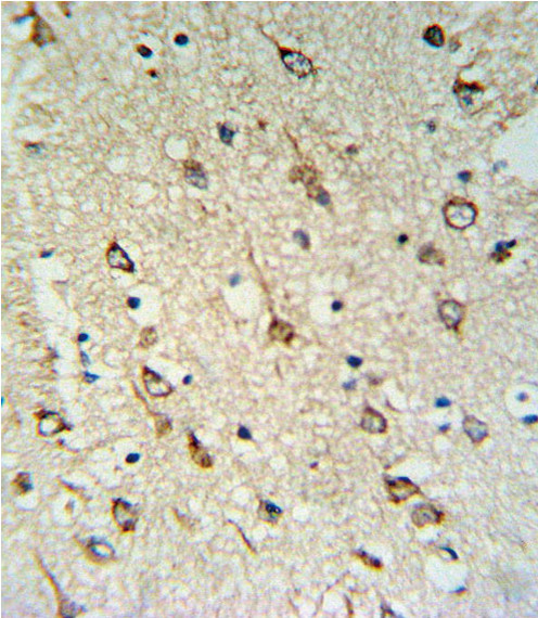 DNAJC6 Antibody in Immunohistochemistry (Paraffin) (IHC (P))