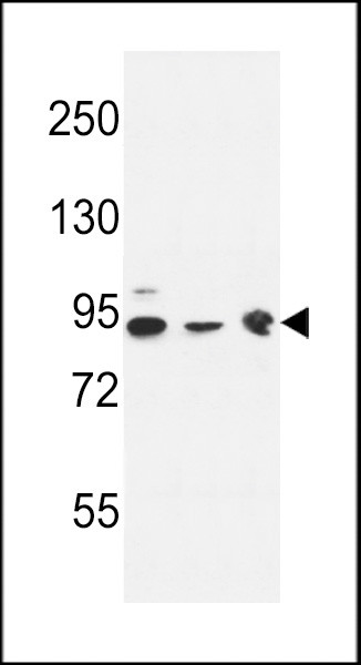 DNAJC6 Antibody in Western Blot (WB)