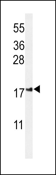 IMMP2L Antibody in Western Blot (WB)