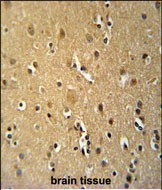 CD30 Antibody in Immunohistochemistry (Paraffin) (IHC (P))