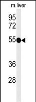 CD30 Antibody in Western Blot (WB)