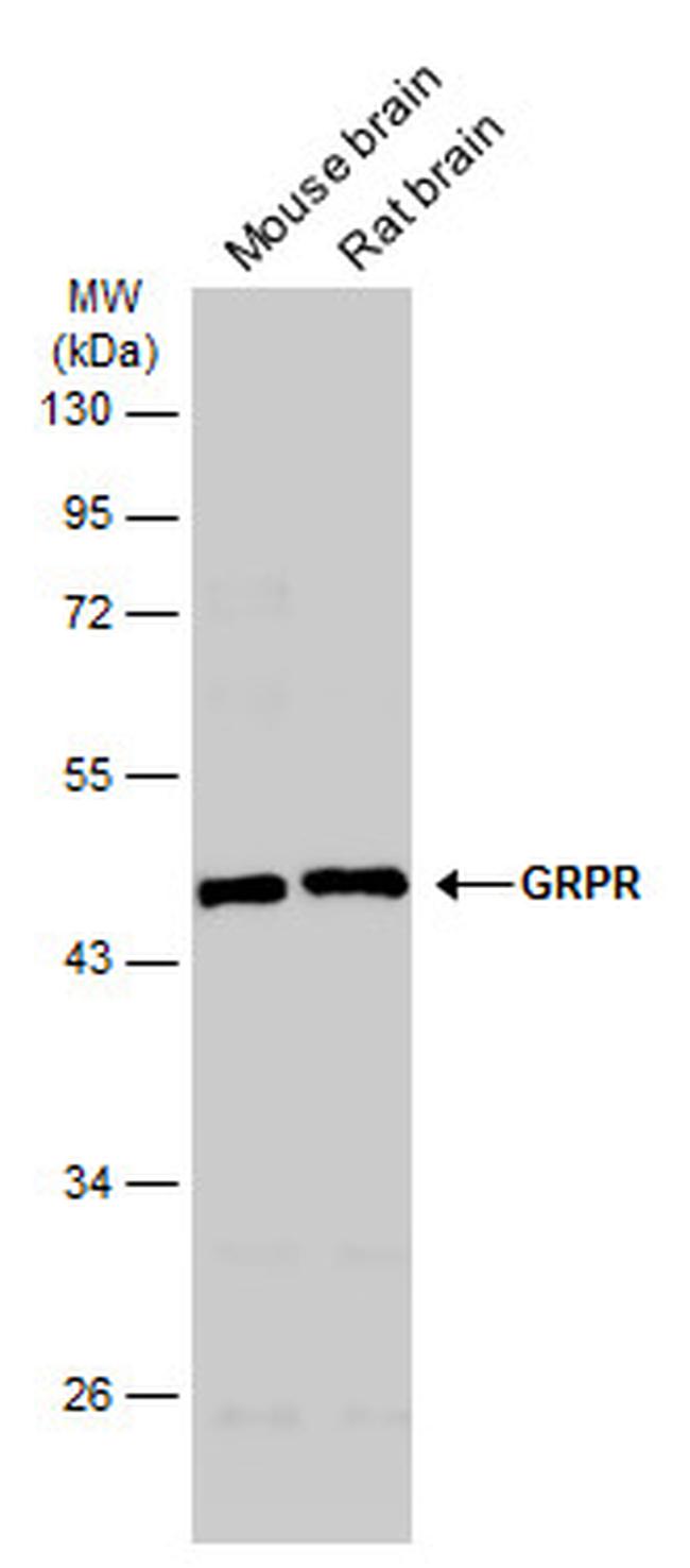 GRPR Antibody in Western Blot (WB)