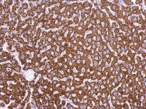 LPAR3 Antibody in Immunohistochemistry (Paraffin) (IHC (P))