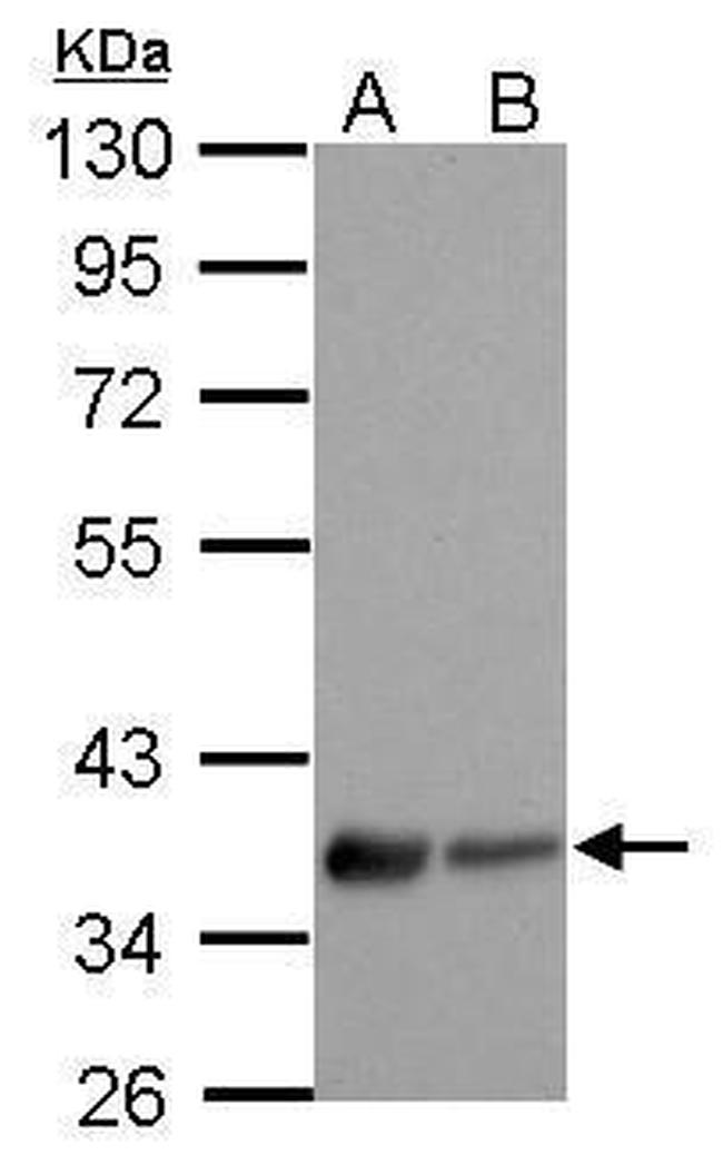 LPAR3 Antibody in Western Blot (WB)