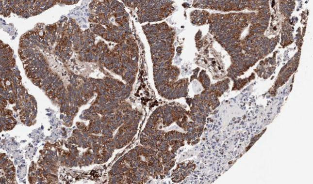 CXCR7 Antibody in Immunohistochemistry (Paraffin) (IHC (P))