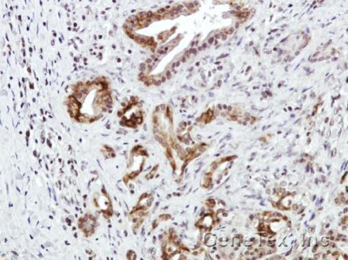 CXCR7 Antibody in Immunohistochemistry (Paraffin) (IHC (P))