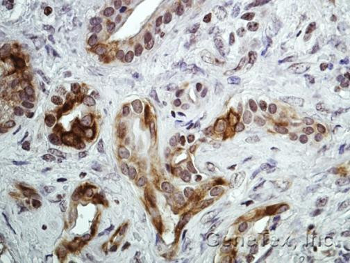 CXCR7 Antibody in Immunohistochemistry (Paraffin) (IHC (P))