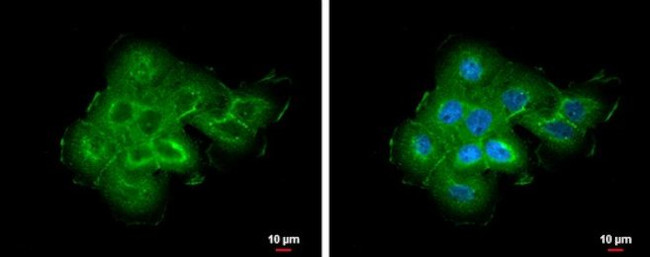 ABR Antibody in Immunocytochemistry (ICC/IF)