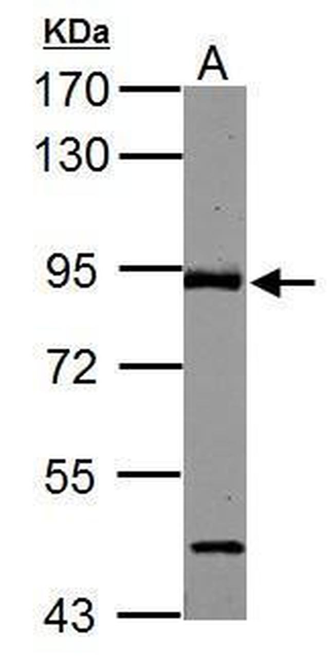 ABR Antibody in Western Blot (WB)