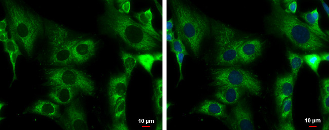 ACADM Antibody in Immunocytochemistry (ICC/IF)