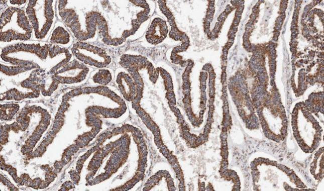 ACADM Antibody in Immunohistochemistry (Paraffin) (IHC (P))