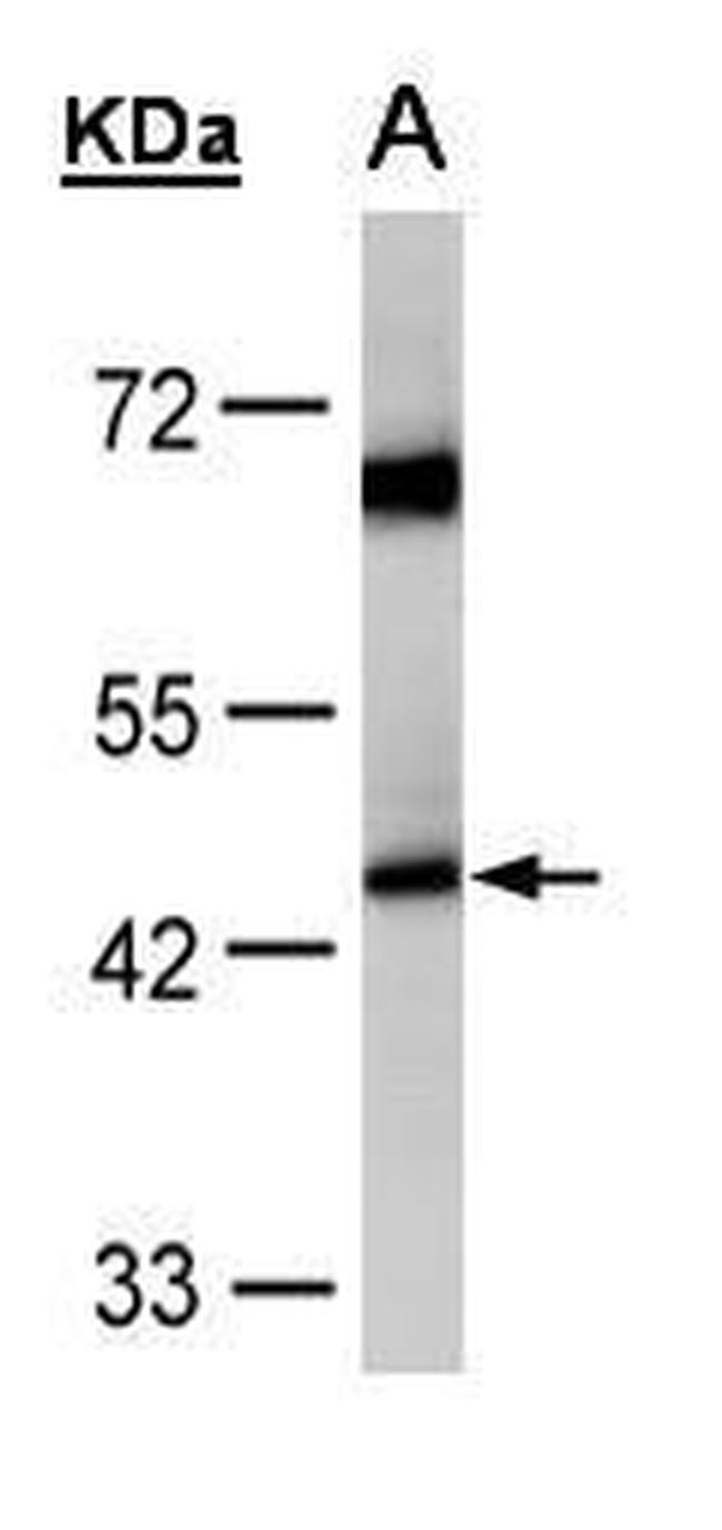 ACADM Antibody in Western Blot (WB)