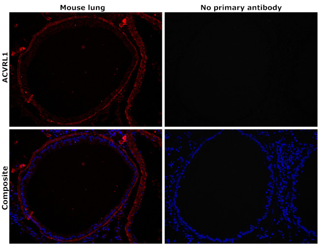 ACVRL1 Antibody in Immunohistochemistry (Paraffin) (IHC (P))