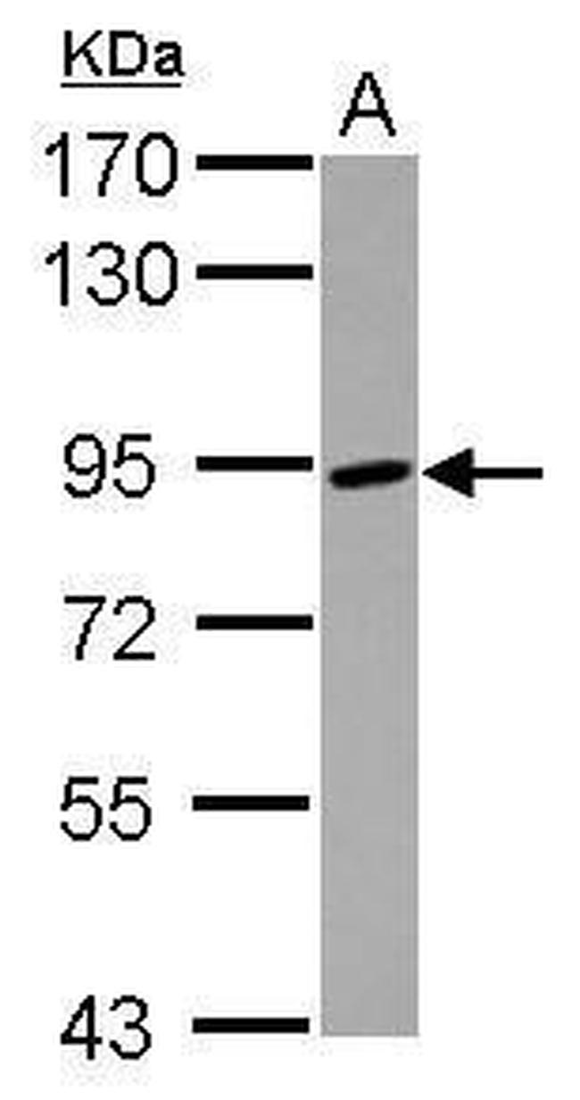 ADAM8 Antibody in Western Blot (WB)