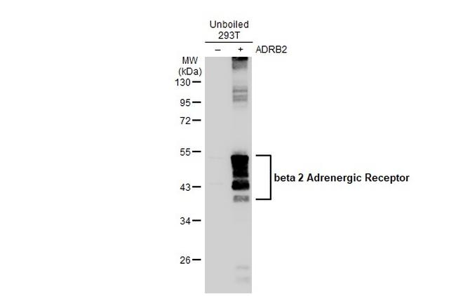 beta-2 Adrenergic Receptor Antibody in Western Blot (WB)