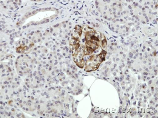 Annexin A2 Antibody in Immunohistochemistry (Paraffin) (IHC (P))