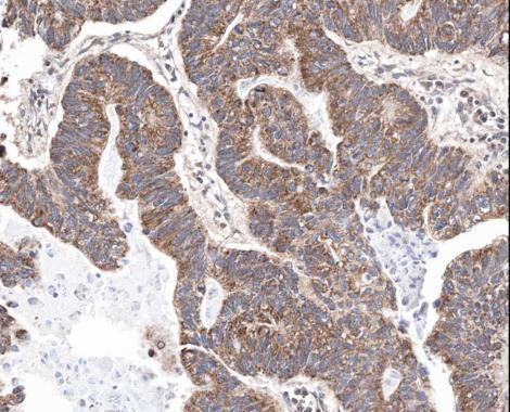 Survivin Antibody in Immunohistochemistry (Paraffin) (IHC (P))