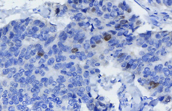 Survivin Antibody in Immunohistochemistry (Paraffin) (IHC (P))