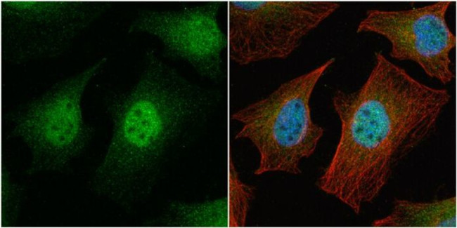 Survivin Antibody in Immunocytochemistry (ICC/IF)