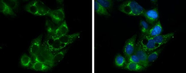 APOE Antibody in Immunocytochemistry (ICC/IF)