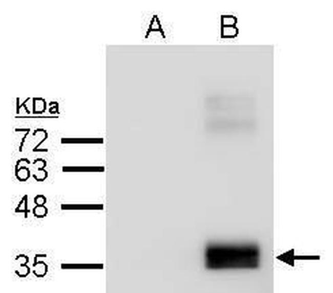 APOE Antibody in Western Blot (WB)