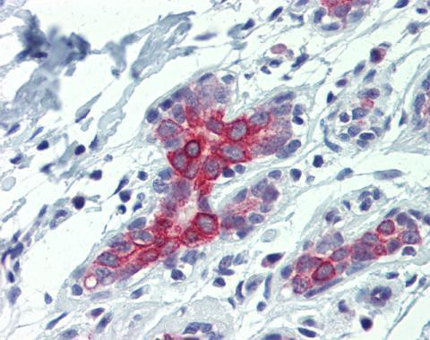 BAK Antibody in Immunohistochemistry (Paraffin) (IHC (P))