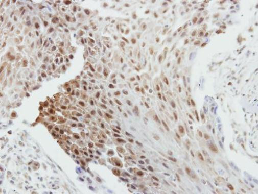 Bcl-2 Antibody in Immunohistochemistry (Paraffin) (IHC (P))