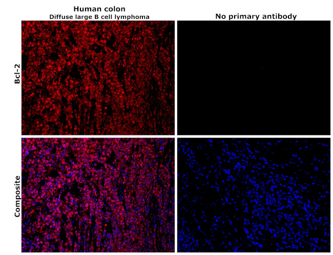 Bcl-2 Antibody in Immunohistochemistry (Paraffin) (IHC (P))