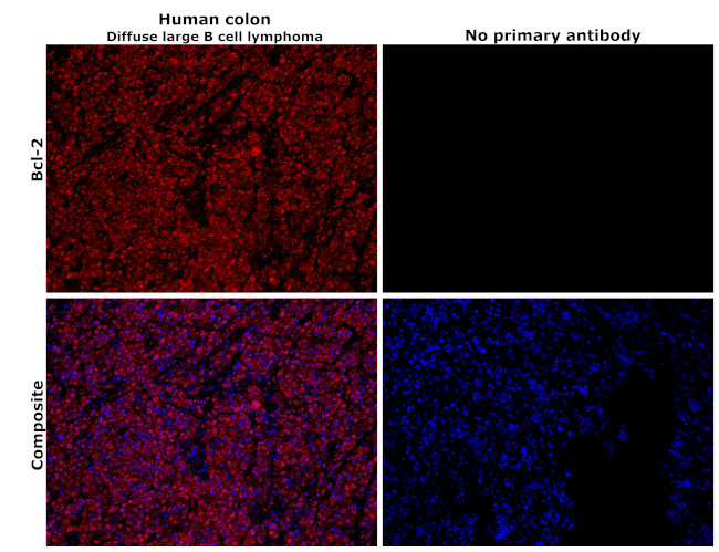 Bcl-2 Antibody in Immunohistochemistry (Paraffin) (IHC (P))