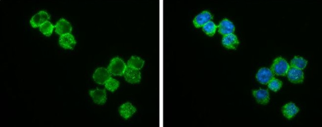 Bcl-2 Antibody in Immunocytochemistry (ICC/IF)