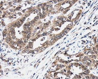 Bcl-2 Antibody in Immunohistochemistry (Paraffin) (IHC (P))