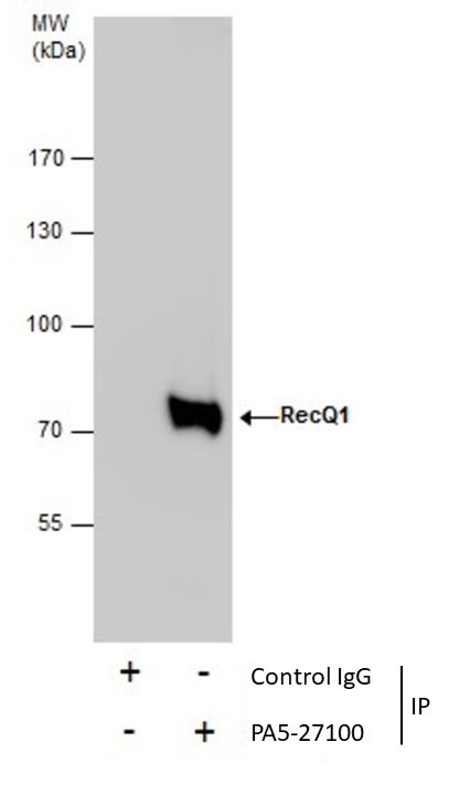 RECQ1 Antibody in Immunoprecipitation (IP)