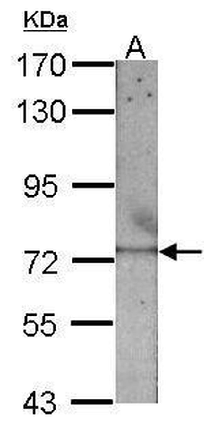 RECQ1 Antibody in Western Blot (WB)